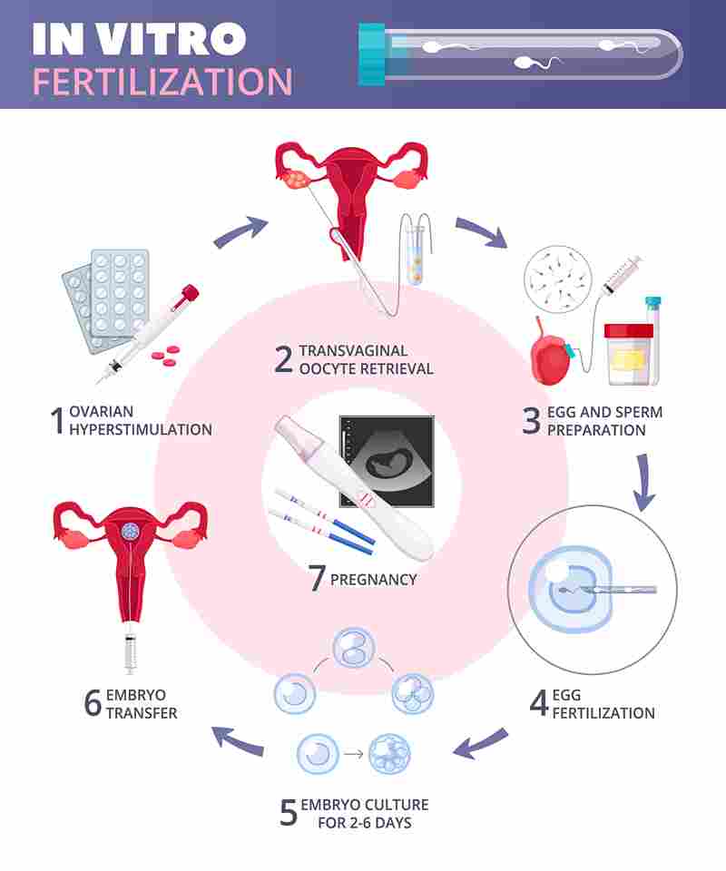 Understanding Ivf A Comprehensive Guide By Dr Hina Ali